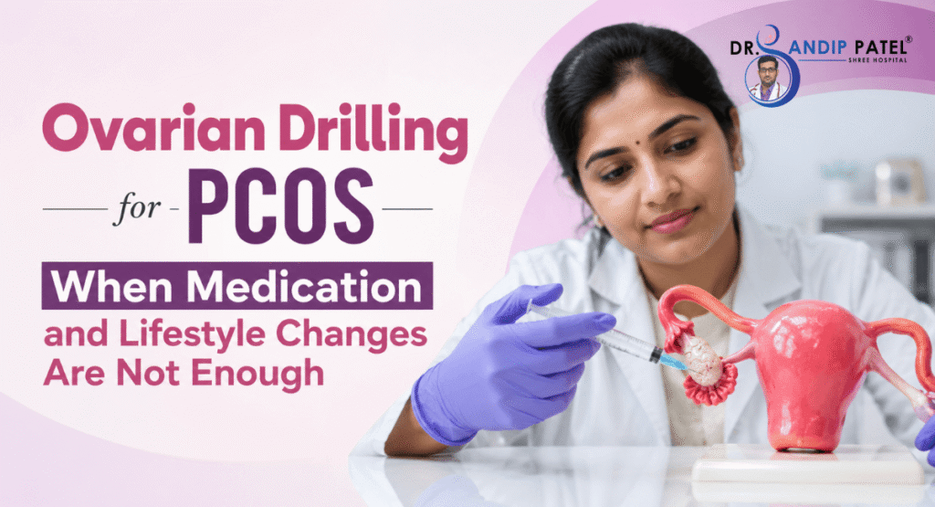 Ovarian Drilling for PCOS When Medication and Lifestyle Changes Are Not Enough